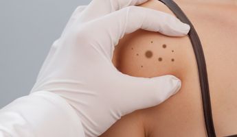 Search and Compare the Best Clinics and Doctors at the Lowest Prices for Mohs Skin Cancer Surgery in Cyprus