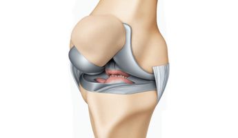 Compare Prices, Costs & Reviews for Knee Ligament Surgery (ACL) in South Korea