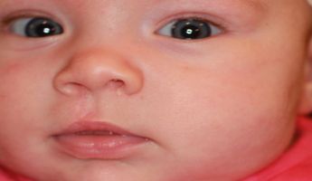 Compare Prices, Costs & Reviews for Cleft Lip or Palate Repair in Thailand