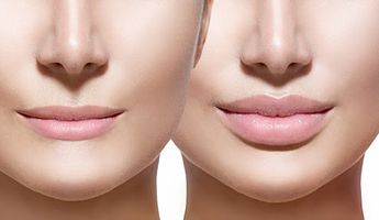 Compare Prices, Costs & Reviews for Lip Reduction in Vietnam