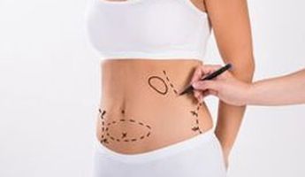 Search and Compare the Best Clinics and Doctors at the Lowest Prices for Liposuction in City of Edinburgh