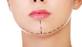 Compare Prices, Costs & Reviews for Mentoplasty in South Korea