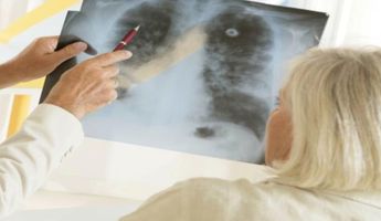 Compare Prices, Costs & Reviews for Lung Biopsy in Austria