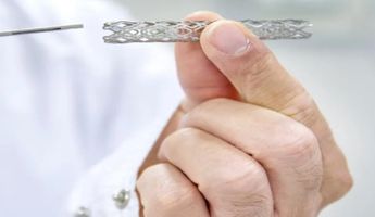 Compare Prices, Costs & Reviews for Stent Insertion in Wiesbaden