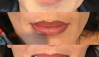 COSMETIC LIP TATTOO Adelaide | Meticulous Brow