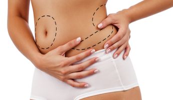Bandingkan Harga, Biaya & Ulasan untuk Tummy Liposuction di Indonesia