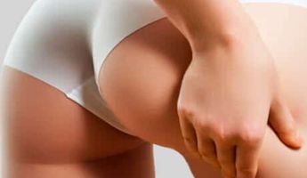 Bandingkan Harga, Biaya & Ulasan untuk Buttock Liposuction di Indonesia