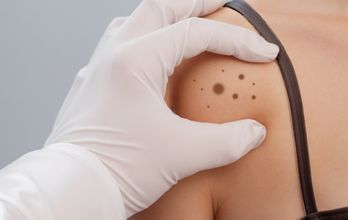 Mohs Skin Cancer Surgery