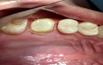 对比关于Duo Dental Care提供的 位于 Rio Champoton牙科套系的评论、价格和成本| M-ME2-2