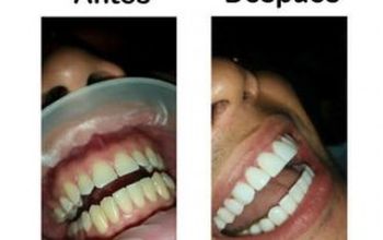 对比关于Sonrisa Perfecta Dental-Tarsys Loayza Roys提供的 位于 波哥大整形与美容手术的评论、价格和成本| M-CO-1-3