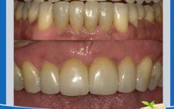 对比关于Dental Cibao提供的 位于 Calle Guayubin Olivo牙科套系的评论、价格和成本| M-DO1-7