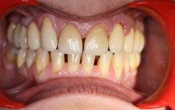 对比关于Your Smile Dental Care提供的 位于 希腊牙科套系的评论、价格和成本| M-GP1-8