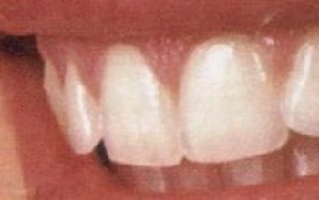 对比关于Split Dent Dental Care提供的 位于 Ul  Gospe u siti牙科套系的评论、价格和成本| M-CP3-6