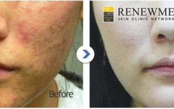 对比关于Renewme Skin Clinic提供的 位于 韩国美容学的评论、价格和成本| M-SO8-30