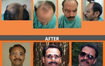 对比关于TRICHOS Hair Transplant Institute提供的 位于 Hyderabad头发修复的评论、价格和成本| M-IN7-29