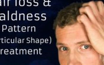 Compare Reviews, Prices & Costs of Hair Restoration in New Delhi at Dr. Rakesh Sood | M-IN11-145