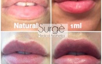 Compare Reviews, Prices & Costs of Plastic and Cosmetic Surgery in Wilmslow at Surge Medical Aesthetics | M-UN1-1244