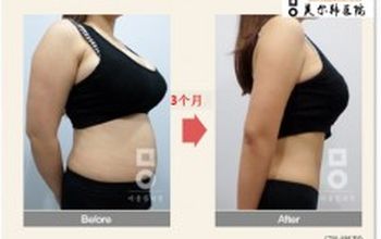 Compare Reviews, Prices & Costs of Bariatric Surgery in Seoul at Miall Korean Medicine Clinic | M-SO8-79