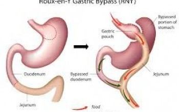 Compare Reviews, Prices & Costs of Gastroenterology in New Delhi at Delhiobesityclinic | M-IN11-228