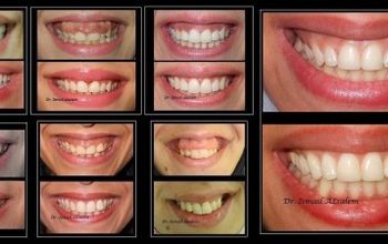 对比关于Alsalem Dental Clinics提供的 位于 Queen Rania St牙科学的评论、价格和成本| M-JO1-41