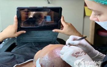 Compare Reviews, Prices & Costs of Ophthalmology in Turkey at MOI Health | 56B57F