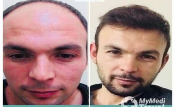 Compare Reviews, Prices & Costs of Ophthalmology in Antalya at SALUSS Medical Center | M-TU2-5