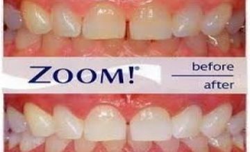 Compare Reviews, Prices & Costs of Dentistry Packages in Tel Aviv at Udental | M-IS4-5