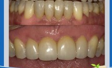 Compare Reviews, Prices & Costs of Dentistry Packages in Santo Domingo at Dental Cibao | M-DO1-7