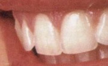 Compare Reviews, Prices & Costs of Dentistry in Split at Split Dent Dental Care | M-CP3-6