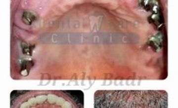 Compare Reviews, Prices & Costs of Dentistry in Egypt at Dental Care Clinic | M-EG1-15