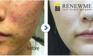 Compare Reviews, Prices & Costs of Cosmetology in South Korea at Renewme Skin Clinic | M-SO8-30