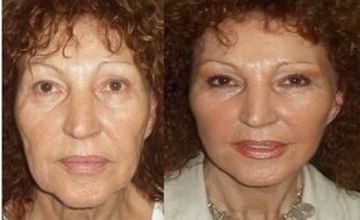 Compare Reviews, Prices & Costs of Gynecology in Cairo at Time Plastic | M-EG1-19