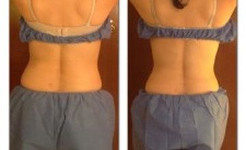 Compare Reviews, Prices & Costs of Cosmetology in Mexico City at Health And Beauty For You | M-ME7-5