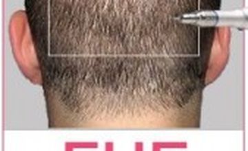 Compare Reviews, Prices & Costs of Plastic and Cosmetic Surgery in Faridabad at Dr. Devesh Aggarwal | M-IN5-4