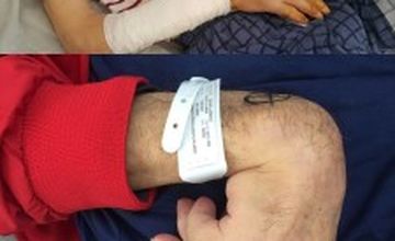 Compare Reviews, Prices & Costs of Hair Restoration in Ankara at Aktif Physical Therapy and Rehabilitation | M-TU1-8