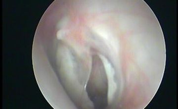 Compare Reviews, Prices & Costs of Physical Medicine and Rehabilitation in Gurgaon at ENT, Head, Neck clinic and hearing aid centre | M-IN6-24