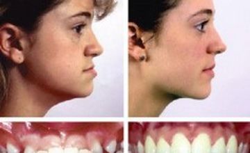 Compare Reviews, Prices & Costs of Gynecology in Bangalore at Health Cottage Hospital (MultiSpeciality) | M-IN1-48