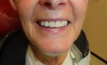 Compare Reviews, Prices & Costs of Maxillofacial Surgery in Los Algodones at Sol Dental Group | M-ME5-23