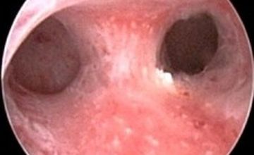 Compare Reviews, Prices & Costs of Plastic and Cosmetic Surgery in Greece at Mr Ioannis Douliotis MBBS MRCOG DFFP | M-GP1-46