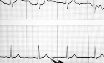 Compare Reviews, Prices & Costs of General Medicine in East Riding of Yorkshire at Ace Medical Services Yorkshire Ltd | M-UN1-484