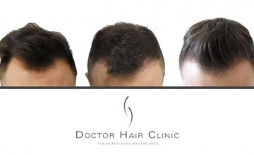 Compare Reviews, Prices & Costs of Hair Restoration in Hungary at Doctor Hair Clinic - FUE Hair Transplant Clinic Hungary | M-HU6-2