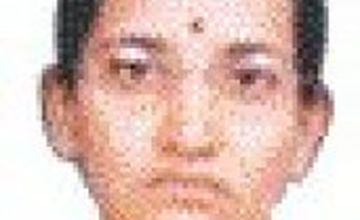 Compare Reviews, Prices & Costs of Hair Restoration in Kochi at Dr. YV Rao Hair Transplant Clinic - Visakhapatnam | M-IN8-185