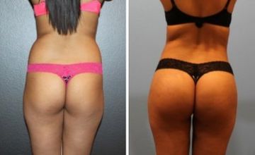 Compare Reviews, Prices & Costs of Ear, Nose and Throat (ENT) in Egypt at Victoria Clinic | M-EG1-85