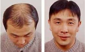 Compare Reviews, Prices & Costs of Cosmetology in Budapest at Exoderm International Medical Centers - Sopron | M-HU1-53