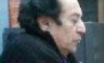 Compare Reviews, Prices & Costs of Hair Restoration in Delhi at Dr Monga Clinic | M-IN11-141