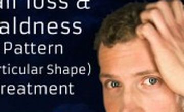 Compare Reviews, Prices & Costs of Hair Restoration in Delhi at Dr. Rakesh Sood | M-IN11-145