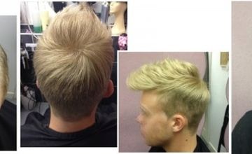 Compare Reviews, Prices & Costs of Hair Restoration in West Midlands at Hough Hair Loss Specialist | M-UN1-618