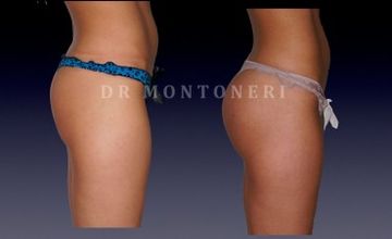 Compare Reviews, Prices & Costs of Dermatology in Paris at Dr Sebastiano Montoneri-Cosmetic and Plastic Surgery | M-FP2-15