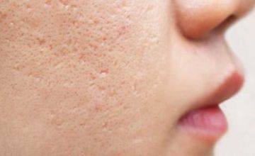 Compare Reviews, Prices & Costs of Plastic and Cosmetic Surgery in West Midlands at Skinfinity Medispa | M-UN1-1055