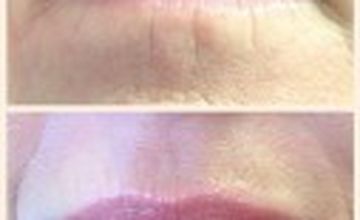 Compare Reviews, Prices & Costs of Plastic and Cosmetic Surgery in South Glamorgan at Rosmedics | M-UN1-1057